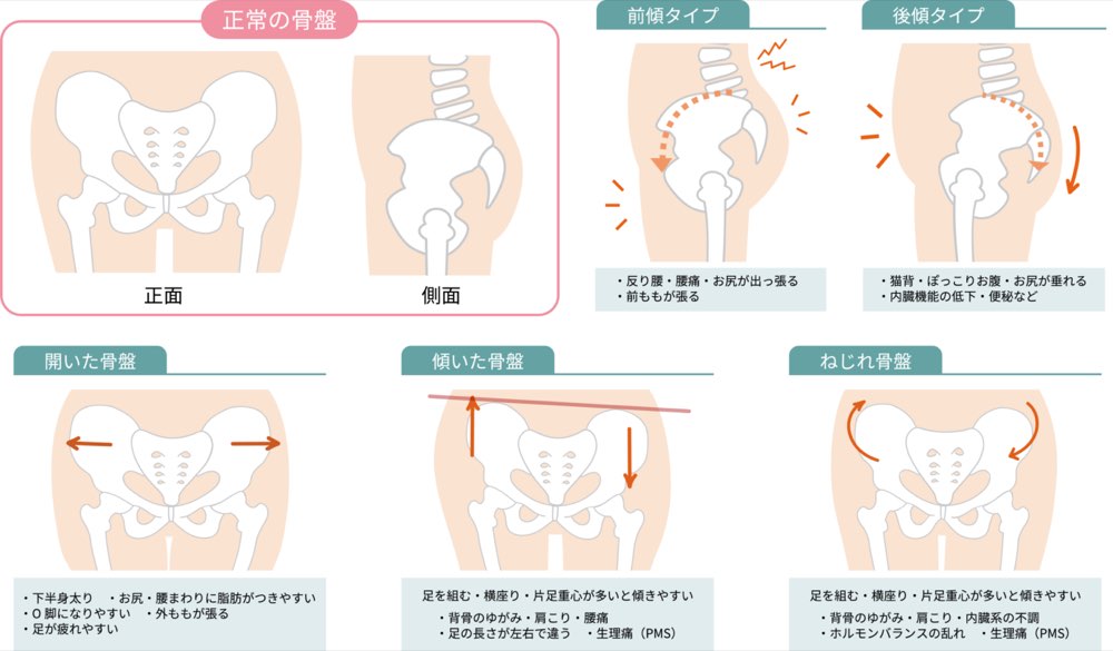 産後の骨盤の状態